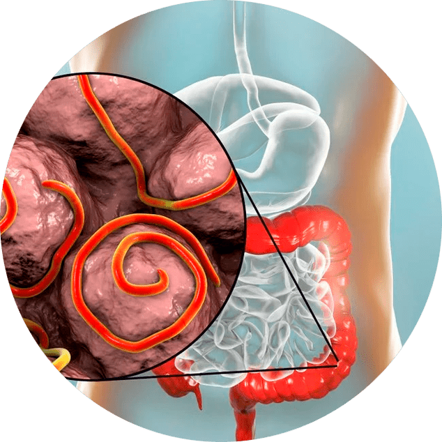 Magen-Darm-Trakt und Parasiten.