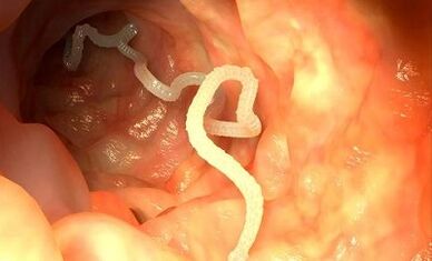 Ursachen von Parasiten im menschlichen Körper.