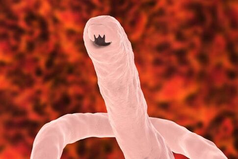 parasitärer Wurm des Menschen